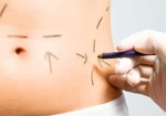 cirurgia-plastica-praia-grande-1452601285