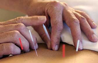 Fisioterapeuta e Acupunturista Jefferson Di Polito - Foto 1