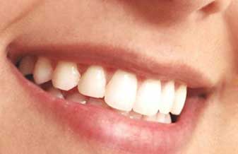 SOS Sorriso - Foto 1